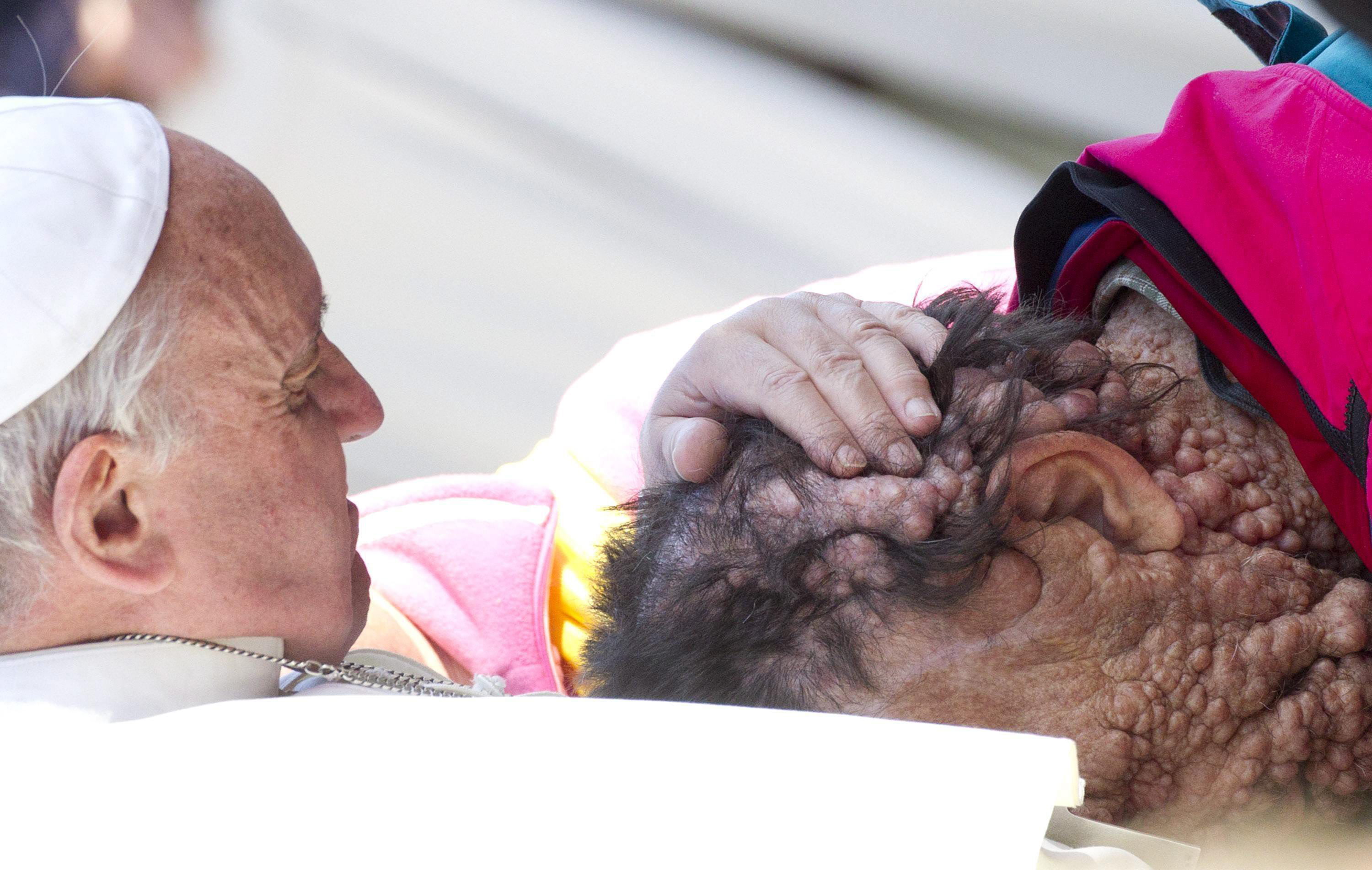 Conmovedor abrazo del Papa a una persona enferma (Fotos)