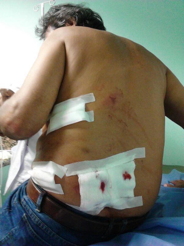 Se reporta herido por perdigones en Carabobo (Foto)
