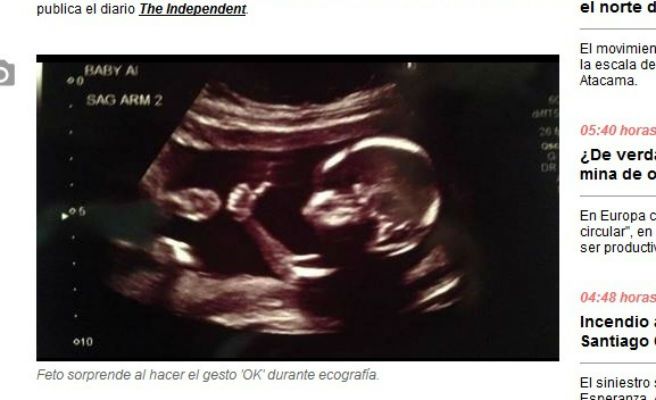 El extraño ecosonograma que muestra un feto con un sorprendente gesto