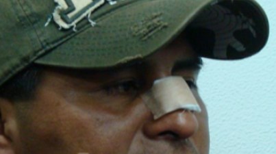 Venezolano con carro diplomático es acusado de arrancarle la nariz a policía en Bolivia