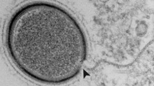 Descubren un nuevo virus gigante de más de 30.000 años y que aún es infeccioso