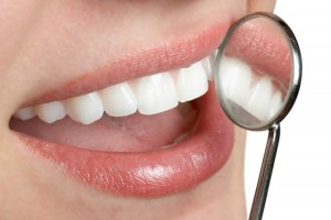 Una mirada a tu boca: Las bacterias de los dientes como nunca antes las habías visto