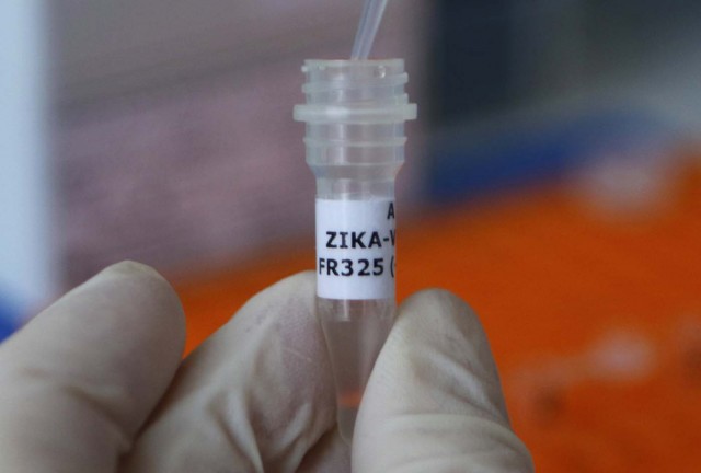 Revelan que cura del virus Zika podría tardarse mínimo tres años por falta de elementos