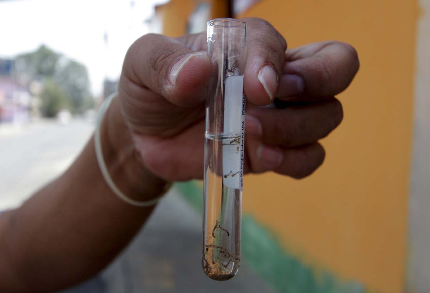 Al menos 31.000 casos de Zika en Colombia incluyendo más de cinco mil embarazadas