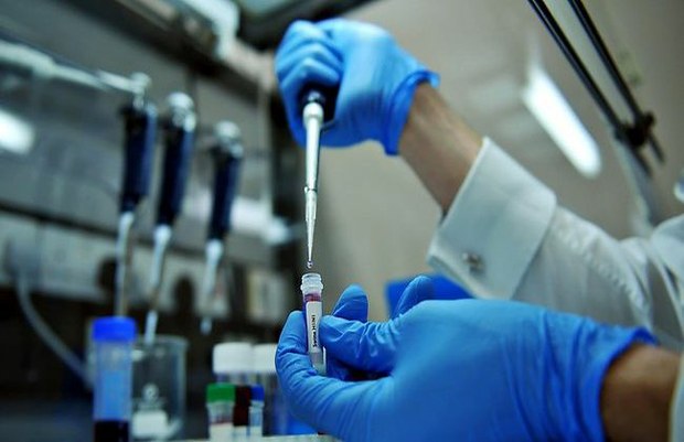 Científicos de EEUU localizan principal problema de las vacunas contra el VIH