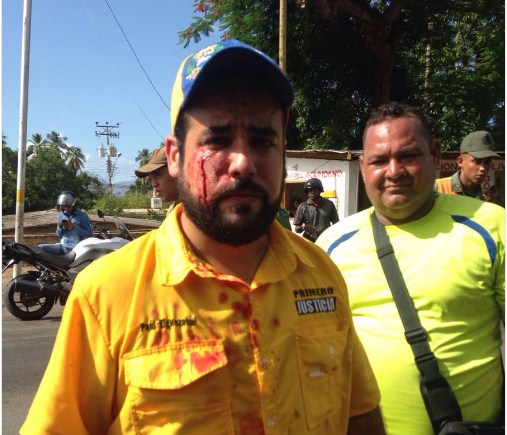 Chavistas agreden a diputado opositor durante  visita de Capriles a Sucre