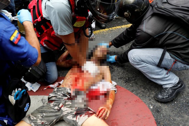 El joven habría recibido el impacto de una lacrimógena. Foto: Reuters