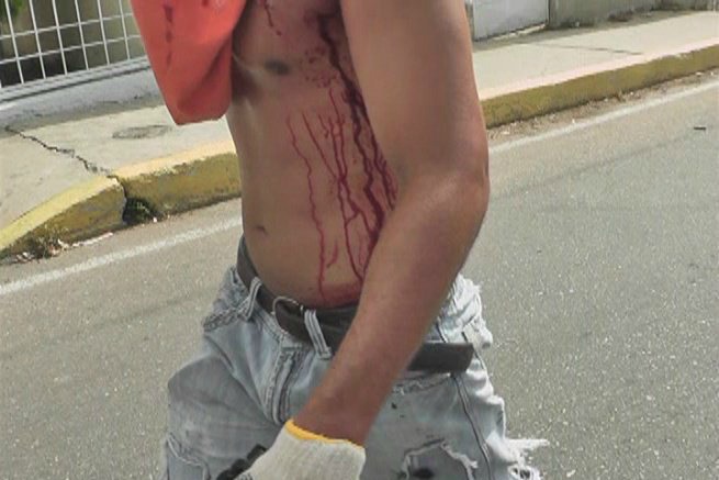 Manifestante resultó herido en el Zulia por represión de la GNB #30Jul