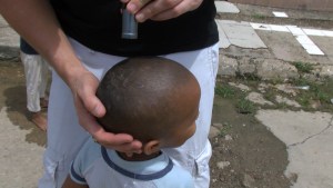 Carlos Lozano: Preocupante  aumento de escabiosis infantil en Carabobo