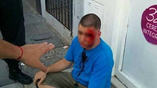 Hombre golpeado tras encontronazo con padre de la niña que acosaba. Foto cortesía Clarín.