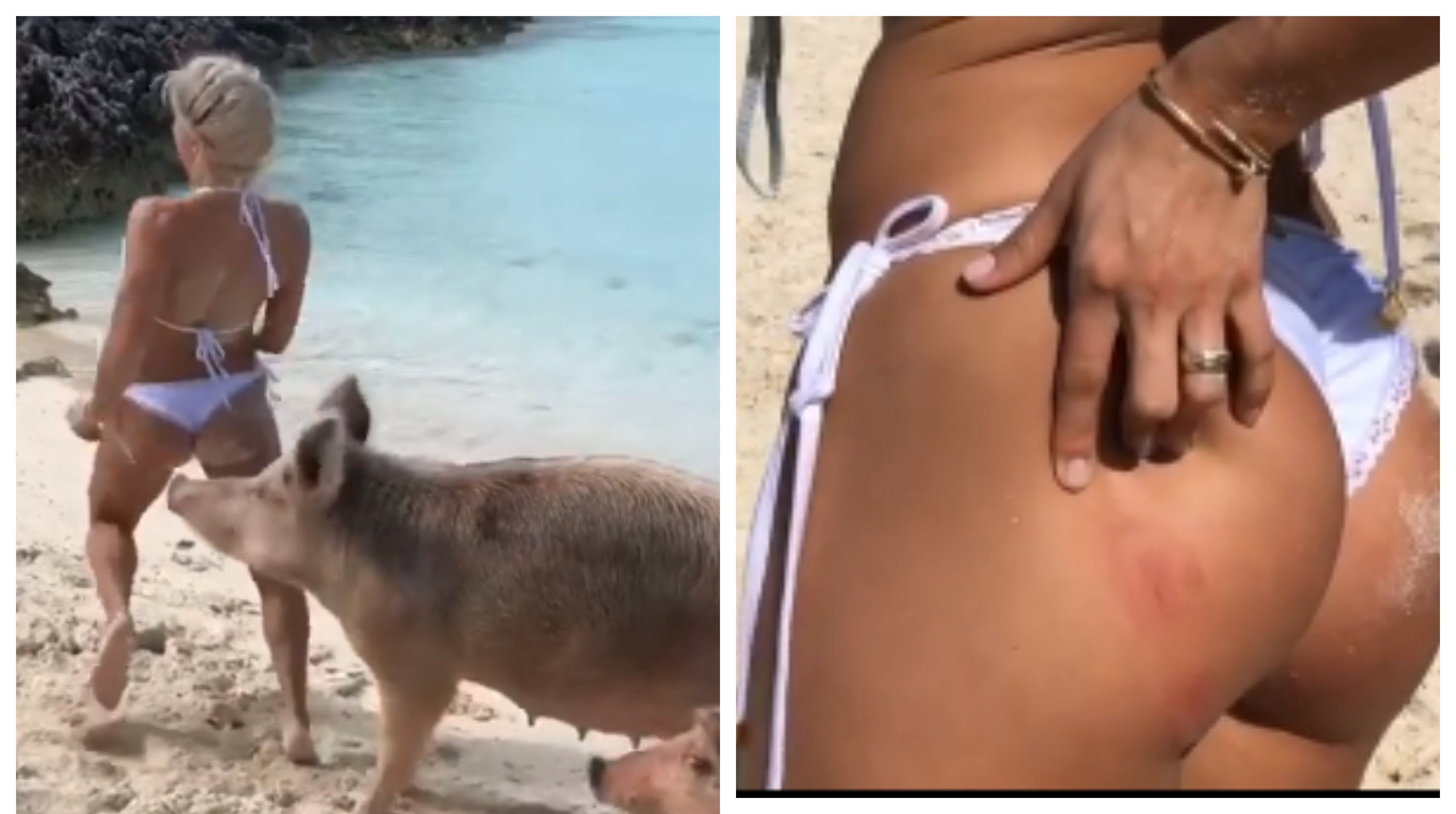 ¡El puerco sádico! Un cochino le mordió la nalga a esta sexy venezolana (Foto+ carnita)