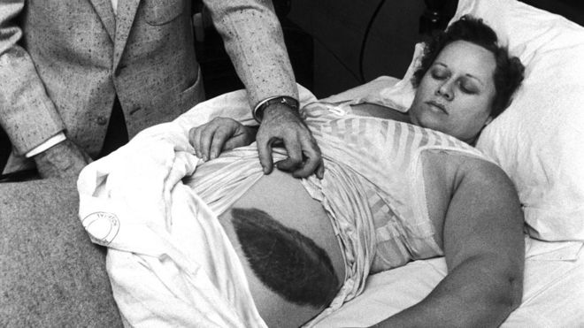 Ann Hodges, la única persona que ha sido golpeada por un meteorito