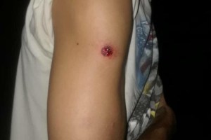 Decenas de heridos por perdigones tras protestas en sede de Corpoelec en Zulia (FOTOS)