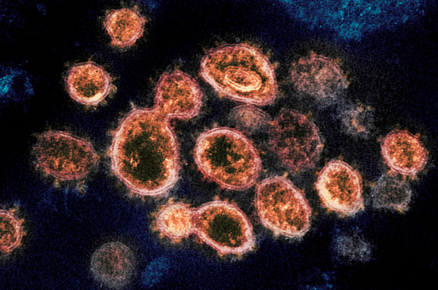 Científicos hallaron una nueva variante del coronavirus en el interior de Sao Paulo