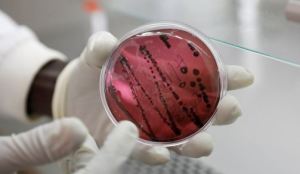 Un virus similar al Ébola prende las alertas tras un brote en Bolivia