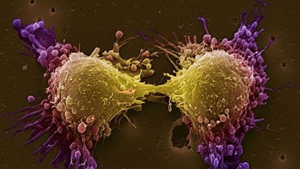 Descifran un mecanismo celular responsable de frenar el crecimiento tumoral