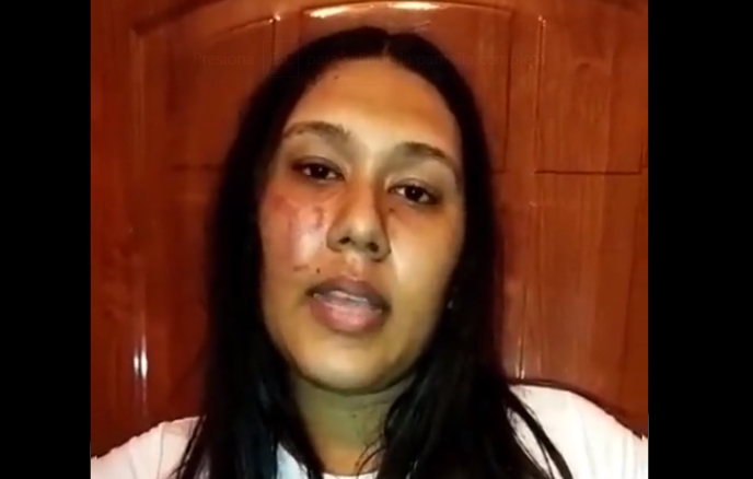 VIDEO: La dejaron con el cachete morado tras jornada violenta del Psuv en Lara