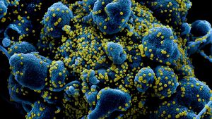 Rusia crea pruebas rápidas para detectar las variantes Iota y Lambda del coronavirus