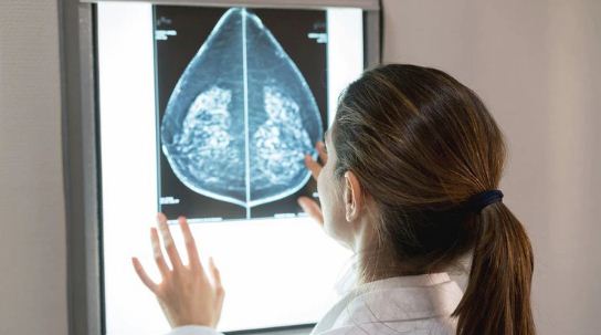 Con un algoritmo detectarán qué pacientes necesitan una cirugía de cáncer de mama y cuáles no