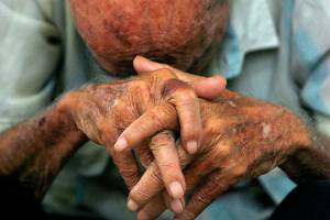 Más del 86% de los adultos mayores viven sumergidos en la pobreza en Venezuela