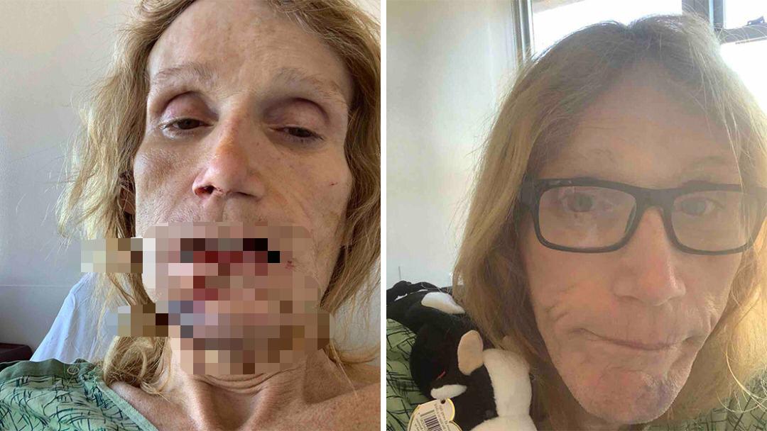 Le rompieron la mandíbula: Mujer trans demandó a autoridades en EEUU por meterla en una celda con hombres