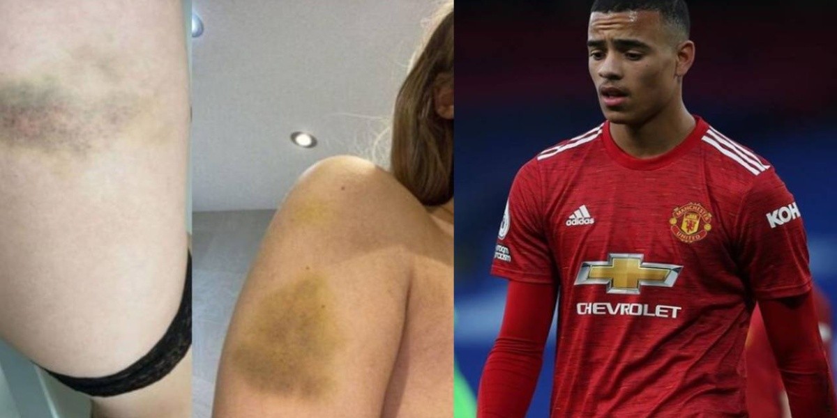 Estrella del Manchester United fue detenida tras presuntamente propinar una golpiza a su novia
