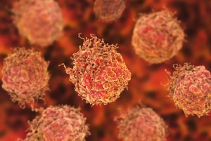 Avance científico: análisis de sangre podría detectar el cáncer antes de que aparezcan los síntomas