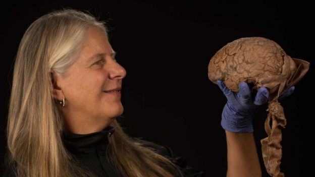 La asombrosa historia de la científica que tras sufrir un derrame cerebral hizo un gran descubrimiento