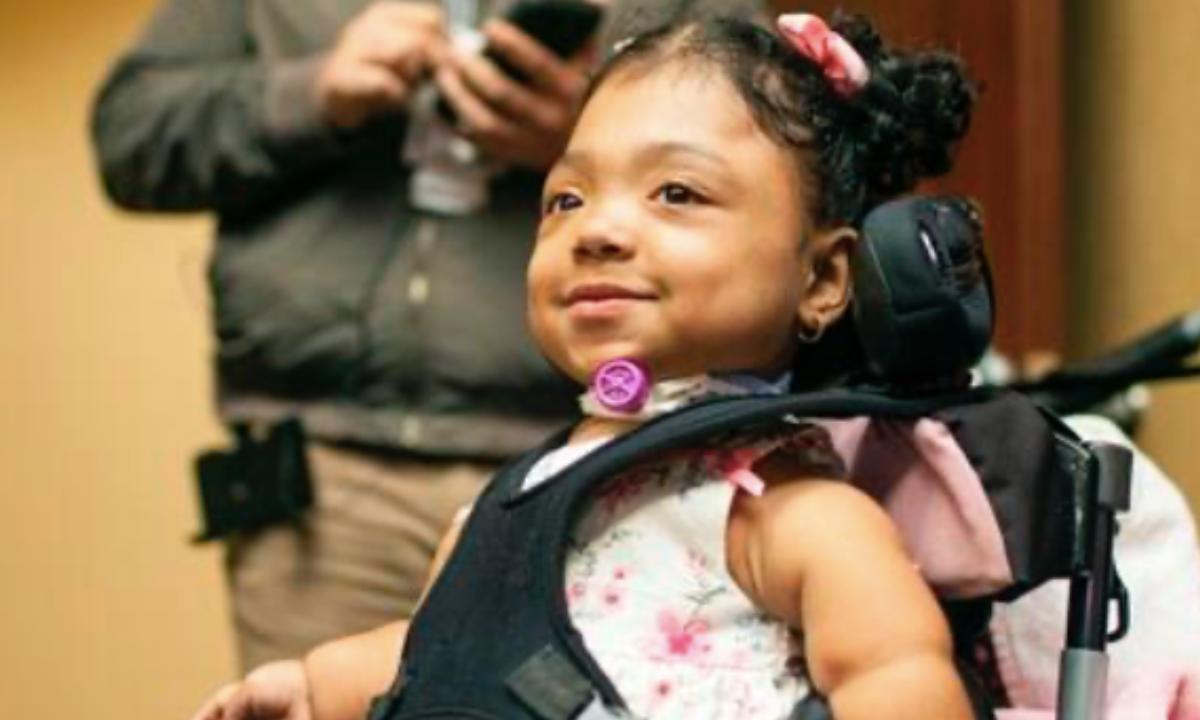 El extraño caso de la niña que nació sin huesos: este experimento le salvó la vida