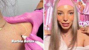 La “Barbiemanía” pone de moda una peligrosa operación estética… ¿de qué se trata?