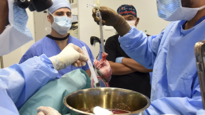 Cirujanos realizaron segundo trasplante de corazón porcino para intentar salvar a un moribundo