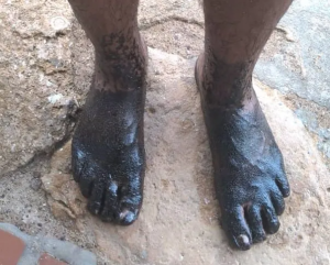 Another oil spill spoils the beaches of Paraguaná in western Venezuela: Tourists flee when they see themselves stained by crude oil