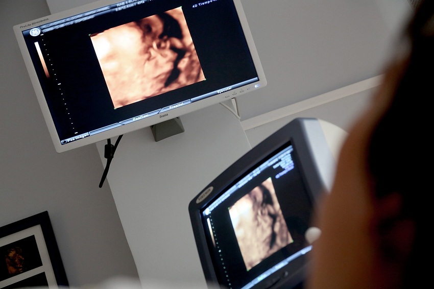 Estar embarazada en Venezuela: los costos de acceder al control prenatal completo